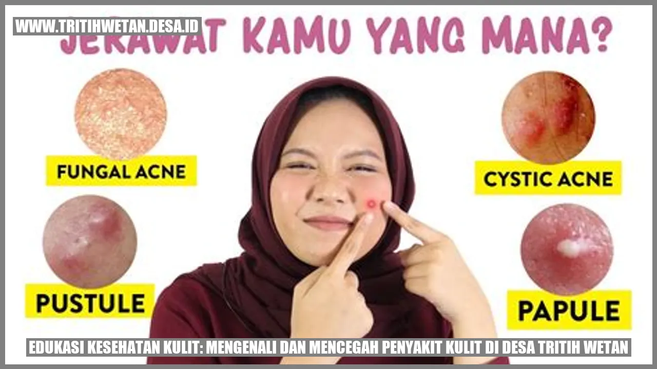 Edukasi Kesehatan Kulit: Mengenali dan Mencegah Penyakit Kulit di Desa Tritih Wetan